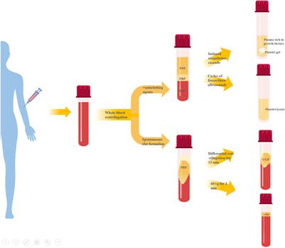 New strategy of personalized tissue regeneration: when autologous platelet concentrates encounter biomaterials